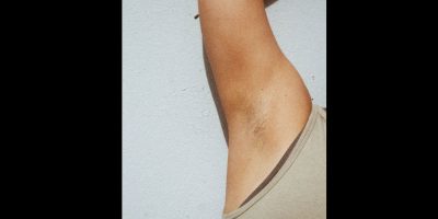 armpit hair via pexels by Deeana Arts