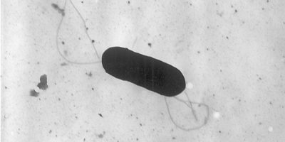 Two Listeria deaths were in Ontario, health ministry confirms