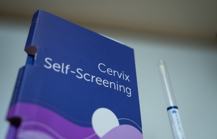 CP - Ontario -cervical cancer screening