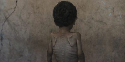 AP - Gaza - famine