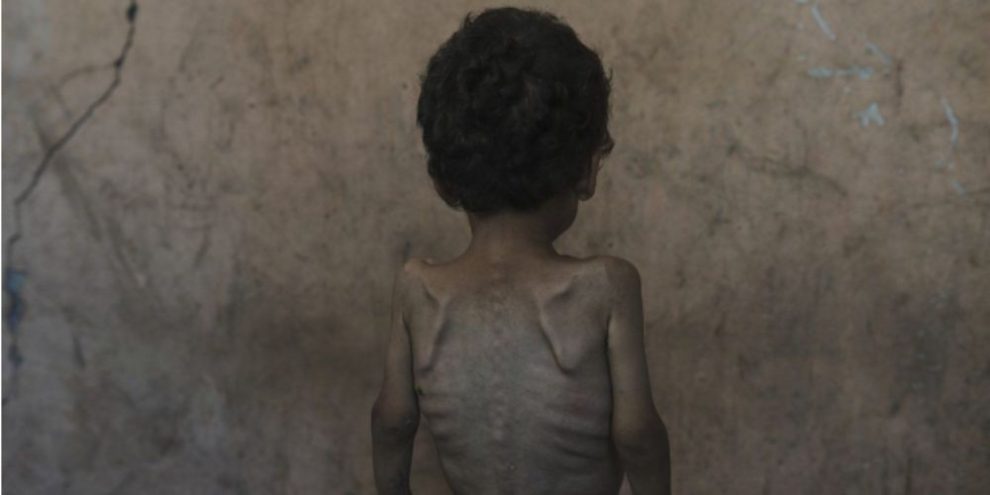 AP - Gaza - famine