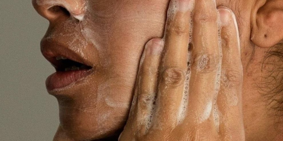 Breakouts after 30? Why adult acne happens and how it can be treated